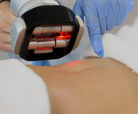 Chronic Pain Lake Mills WI Red Light Therapies Chronic Pain Lake Mills WI Red Light Therapies